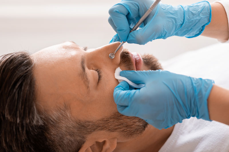 An esthetician removes a blackhead from a man’s face during an extraction at a facial spa near Dallas, Texas.